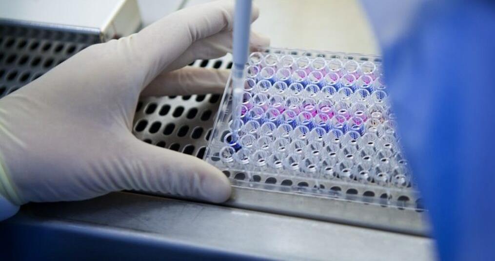 Avancée scientifique majeure dans la lutte contre la maladie de Parkinson