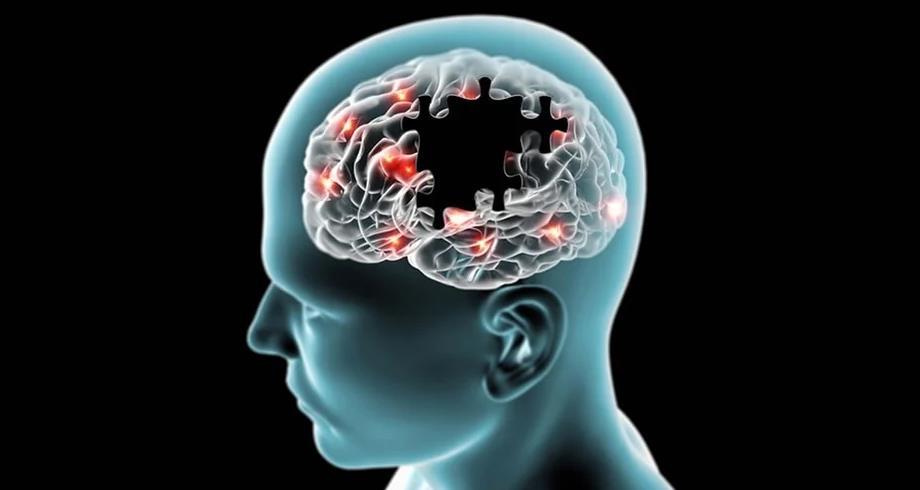 دراسة تكشف تقنية علاجية جديدة لإزالة البروتين المسبب لمرض الزهايمر من الدماغ