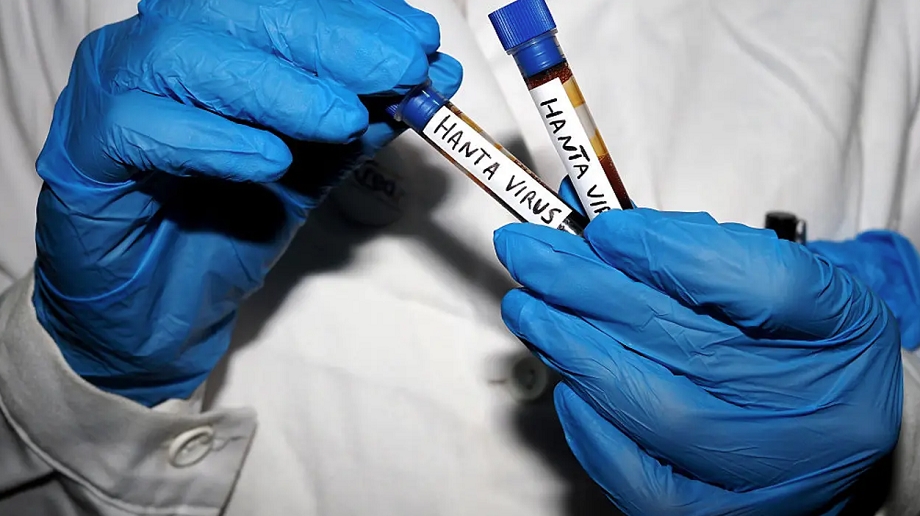 Hantavirus : Trois personnes sous surveillance dans le Maryland et en Virginie