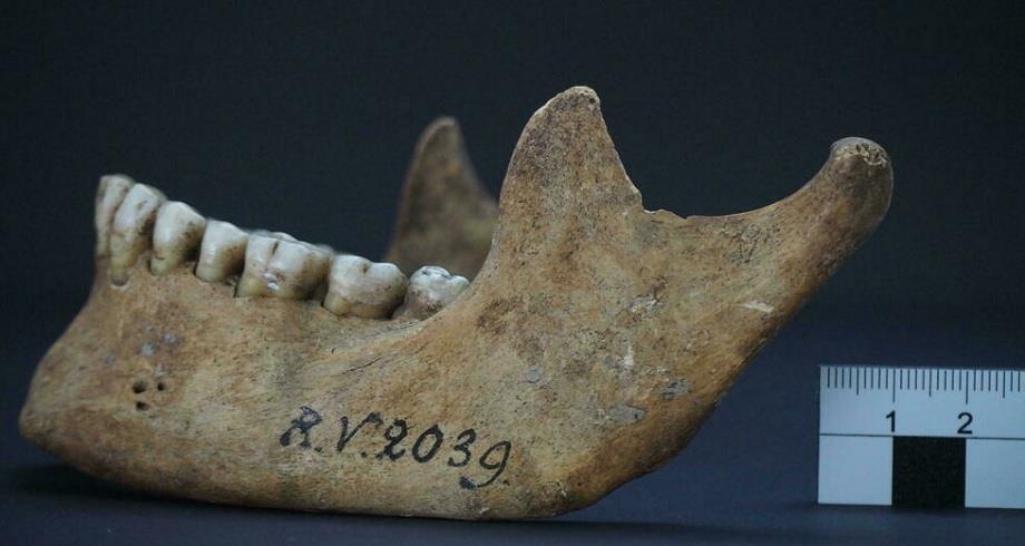 Découverte de la première victime connue de la peste il y a 5.000 ans