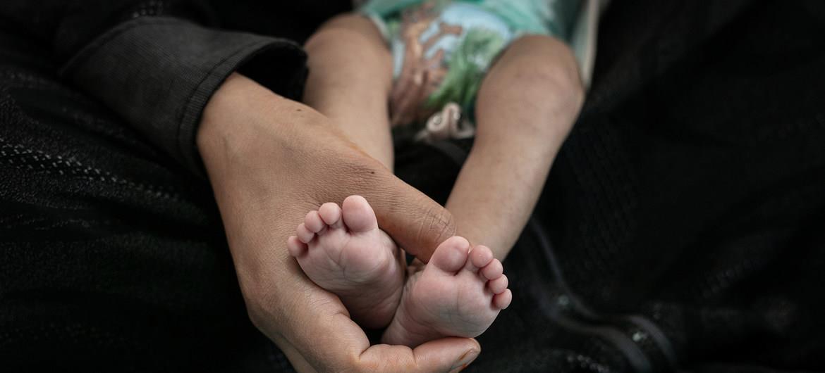 منظمة الصحة العالمية: 75 بالمئة من أطفال اليمن يعانون من سوء التغذية المزمن