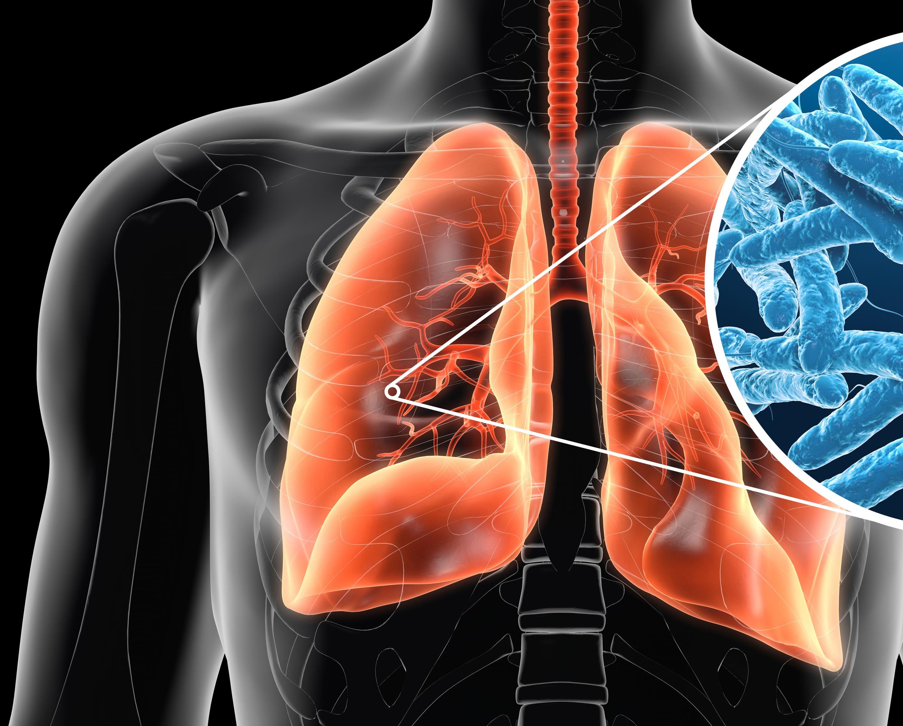 Cas de légionellose à Milan: Un mort et huit personnes hospitalisées